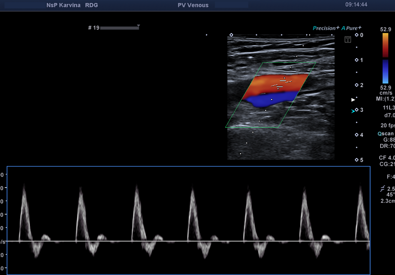 arterie